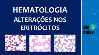 Anisocromia, Anisocitose e Poiquilocitose: Alterações no Hemograma (Hematologia) - Bio Aulas