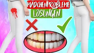 Nervige Mädchen Probleme und Lösungen! Gelbe Zähne, Perioden Fail & Mehr!