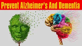 Prevent Alzheimer's and dementia: Top 10 Foods That Boost Memory.