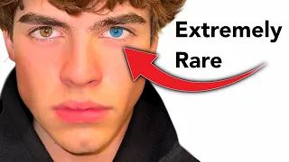 10 Signs That You Have Elite Genetics