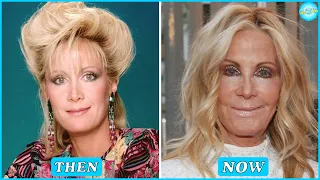 20 Celebrity Plastic Surgery Disasters You Didn't Know About | Celebrities Then And Now