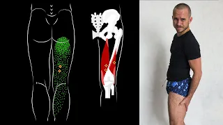 БОЛИТ НОГА ОТ БЕДРА ДО КОЛЕНА СЗАДИ 🔴 КАК УБРАТЬ БОЛЬ В БЕДРЕ (мышцы задней поверхности бедра)