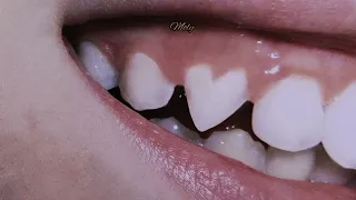 baby teeth/Flower Face[AR Sub]