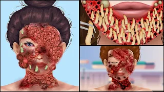 ASMR Treatment Remove DogTicks & Maggot Infected Face | Severely Injured Animation | Universe ASMR