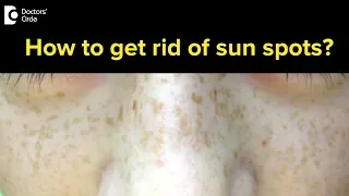 How to get rid of sun spots? - Dr. Urmila Nischal
