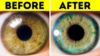 7 Things That Can Change Your Eye Color