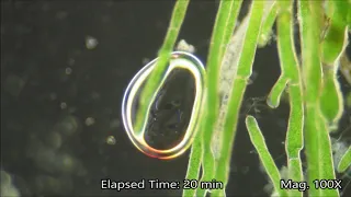 Photosynthesis Under the Microscope
