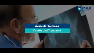 Explaining causes and treatments for Avascular Necrosis