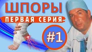 ПЯТОЧНЫЕ ШПОРЫ 💥Секреты От Фиша 👣 ЧАСТЬ ПЕРВАЯ - От Боли к Здоровью! 💪🎯💥