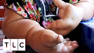 Thai Woman May Have the World's Largest Arms and Hands | Body Bizarre