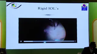 AIOC2020 IC145 T4 Dr Manoj Khatri Nucleus Drop and Dropped IOL