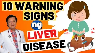 10 Warnings Signs ng Liver Disease. - By Doc Willie Ong (Internist and Cardiologist)