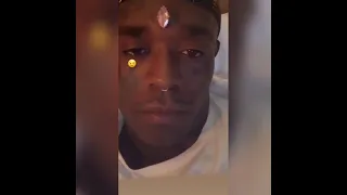 Lil uzi vert's 3rd EYE😁(pierced diamond on his forehead)