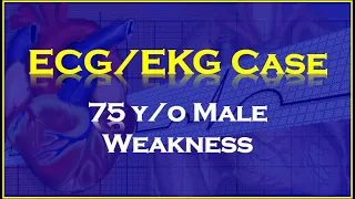 ECG/EKG Case Review - 75 Male with Weakness