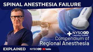 SPINAL ANESTHESIA FAILURE - Crash course with Dr. Hadzic