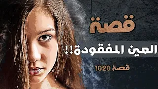 1020 - قصة العين المفقودة!!