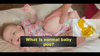 What is normal baby poo?