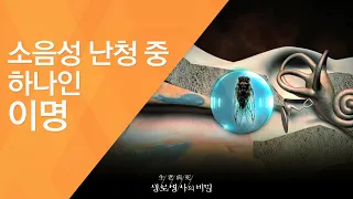 소음성 난청 중 하나인 이명 - (2011.10.1_387회 방송)_볼륨을 줄여라, 소음성 난청