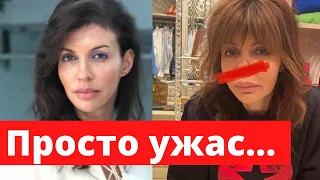 ШОК! Алиса Аршавина опубликовала кадры изуродованного лица