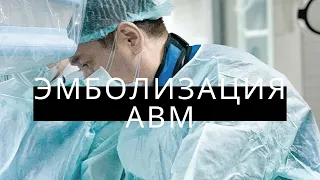 Эмболизация АВМ