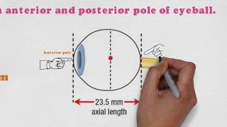 Biometry-2 | Measurement of Axial length | Smart Optometry