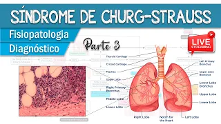 Síndrome de Churg-Strauss │ Fisiopatologia das Vasculites (Parte 3)