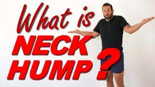 What The HECK Is NECK HUMP?