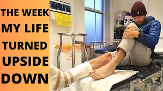BROKEN ANKLE SURGERY // The week my world turned UPSIDE DOWN. Literally.