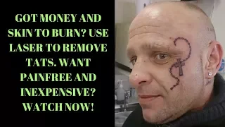 Sean Sarantos - THE TATTOO REMOVAL PROCESS - Sean Sarantos