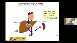 1 Portal Hypertension -Dr SK Sarin