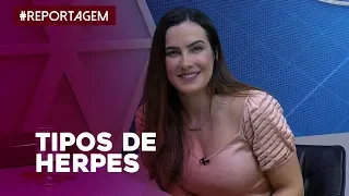 Conheça os diferentes tipos de herpes