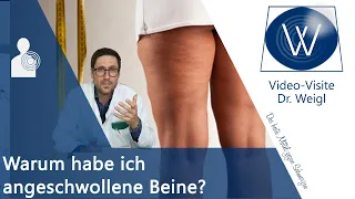 Beinödeme - Geschwollene, dicke Beine: Wasser in den Beinen durch Hitze, Herzinsuffizienz, Lymphödem