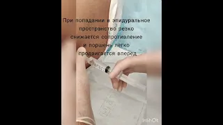 Что такое эпидуральная анестезия при родах?