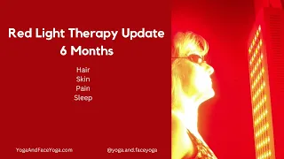 Red Light Therapy Update - 6 Months