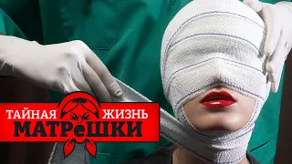 Специальная Пластическая Операция для кремлевских лузеров. Тайная жизнь матрешки