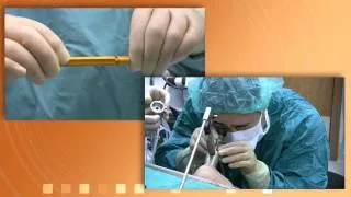 Doctor Interview: Subglottic Stenosis