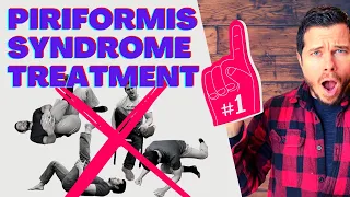 The BEST Exercise For Piriformis Syndrome?!