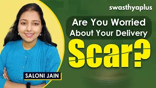 How to Heal Your C-section Delivery Scar Faster? | Dr Saloni Jain