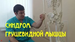 Синдром грушевидной мышцы  Piriformis syndrome