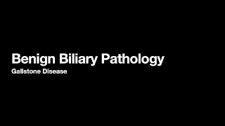 Biliary Pathology / Gallstones