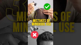 Minoxidil Biggest Mistakes - Don’t Do It Please! #minoxidil