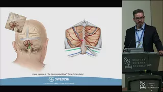 Anatomy of the Dorsal Brainstem, Fourth Ventricle and Telovelar Approach - Zachary N. Litvack, MD