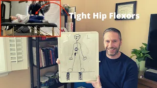 Why Hip Flexors Get Tight: The Role of Sensory Processing