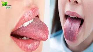 5 Secrets Your Tongue Reveals about Your Health | Tongue Bumps Remedies