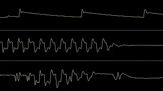 Jammer - "Amanita Overdose" / C64 Oscilloscope Visualization