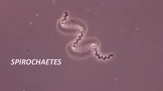 Spirochetes seen through a compound microscope