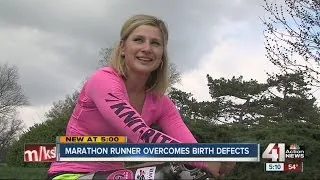 Marathon runner born after Chernobyl nuclear disaster overcomes birth defects