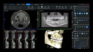 Romexis 6.1 Basics