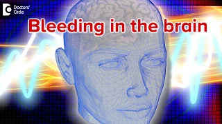 Bleeding in the brain - Dr. Avinash K M