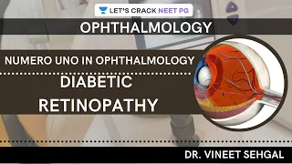Numero Uno in Ophthalmology| Diabetic Retinopathy | NEET-PG 2021 | Vineet Sehgal